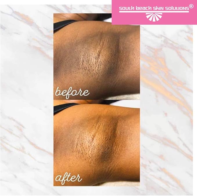 south beach cream for sensitive areas