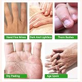 YUNY Hand Mask 3 Pack Moisturizing Gloves for Dry Rough Skin Shea Butter view 4