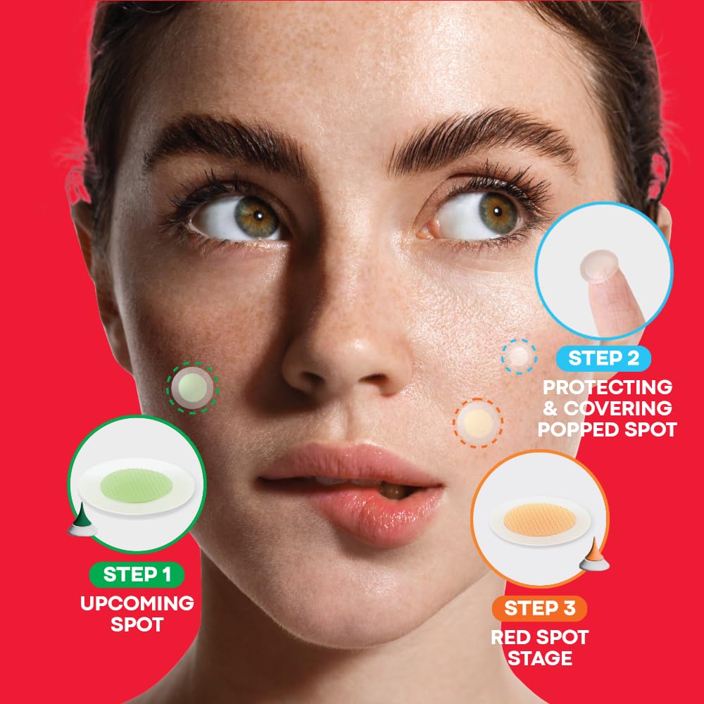 Spot Eraser Set of 84 Patches | Pimple Patches for Face for All Stages of Pimples | Face Patches that Feature Hydrocolloid Patches for Faster Results | Dark Spot Patch Pimple Set
