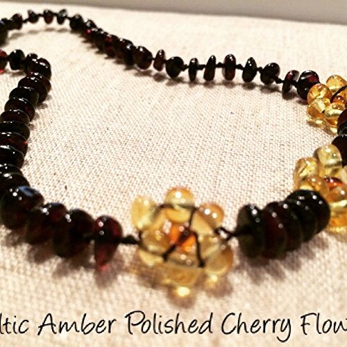 baltic essentials amber necklace