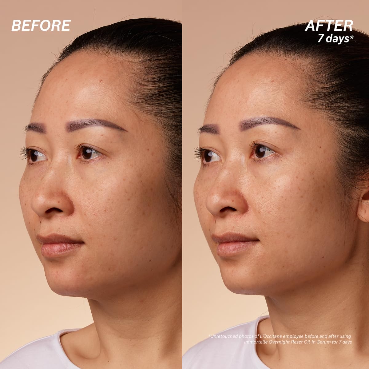 L'Occitane Immortelle Overnight Reset Oil-In-Serum: More Radiant Skin In 1 Night, Smooth Fine Lines, Revitalize Dull Skin, Award-Winner