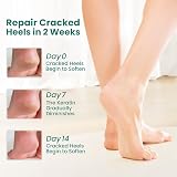Welnove Moisturizing Heel Socks Aloe Vera Gel Lining 2 Pairs Extra Large view 2