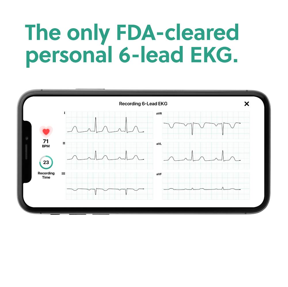 KardiaMobile 6-Lead Personal ECG Heart Rate Monitor, Detects Atrial Fibrillation, Trusted by the NHS, Results in 30 Seconds - Image 4