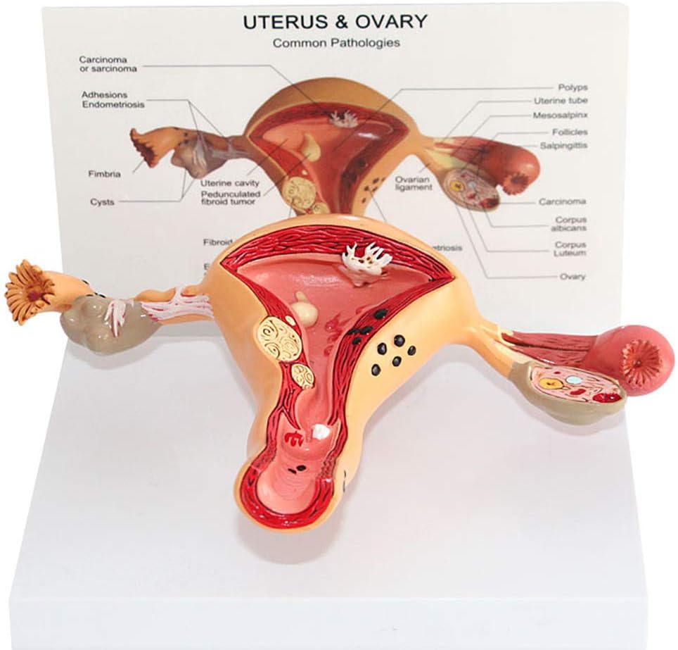 Scientific Human Anatomy Uterine Lesion Model Anatomical Model Of Female Internal And External Organs Medical Organ Teaching Models Amazon Co Uk Sports Outdoors