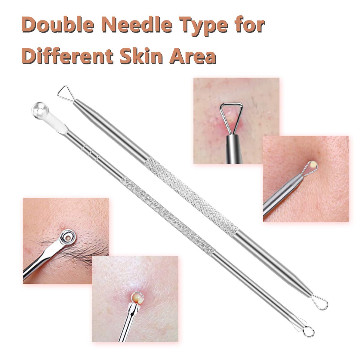Pimple Popper Tool Kit,Blackhead Remover kit,christmas gifts Stocking Stuffers 6 PCS Ingrown Hair Removal Kit,White heads Removers,Pore Extraction Tool,Facial Skin Acne Zit Tools With A Leather Bag: Beauty