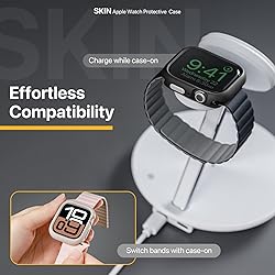 MAGEASY Designed for Apple Watch Series 10 Case