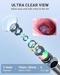 Anykit Digital Otoscope with Gyroscope, 4.5 Inches