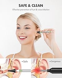 Anykit Digital Otoscope with Gyroscope, 4-inch IPS