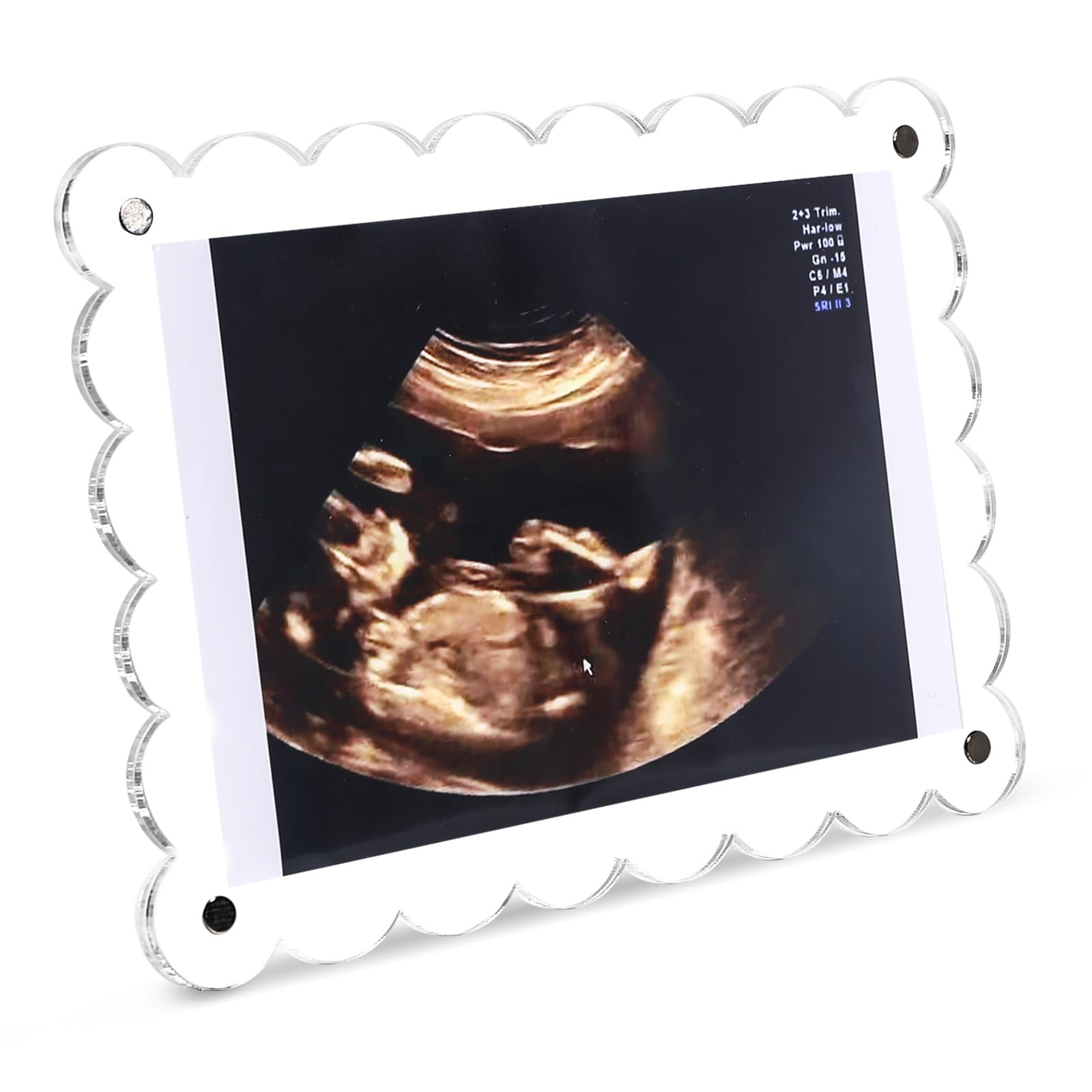 Photo 1 of Mlatnod Magnetic Clear Acrylic Scalloped Baby Ultrasound Picture Frame - Sonogram Frame for Refrigerator, Display for Pregnancy Announcement, Gender Reveal & Expecting Parents Gifts(No Stand)