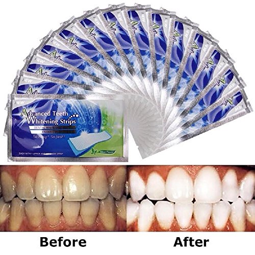 Advanced 3D Teeth Whitening Strips, See Professional White Effects 28
