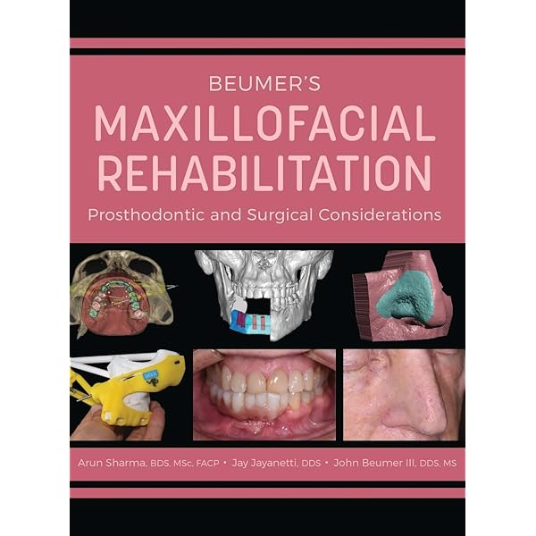 健康・医学 267 Aligner Orthodontics and Orofacial Aligner Orthodontics and Orofacial Orthopedics - Kindle