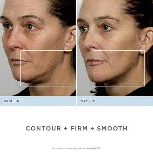 nuface mini facial toner amazon