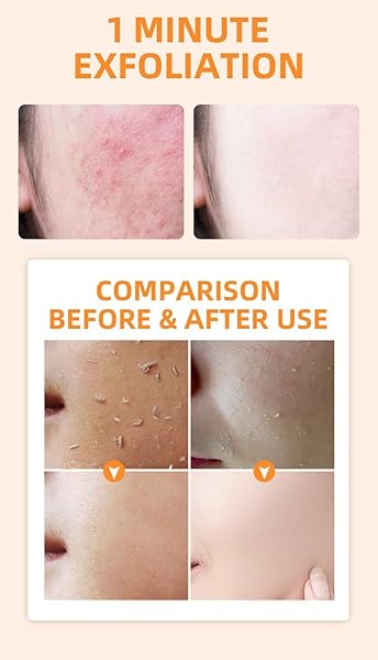 2 PCS ORANGE PURIFYING EXFOLIATING GEL,FACE AND BODY CLEANSING SOFT SCRUB GEL
