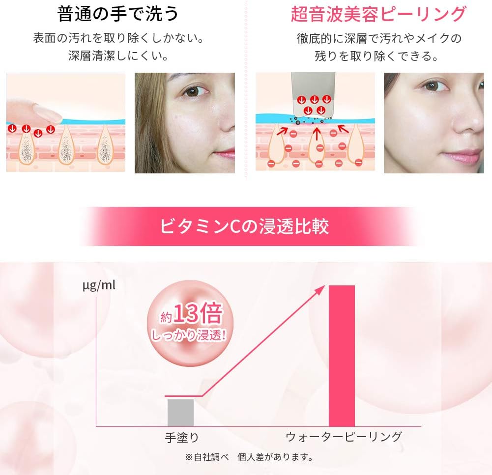 Amazon Anlan ウォーターピーリング 超音波ピーリング 美顔器 スマートピール イオン導入 イオン導出 超音波振動 毛穴クリーナー 多機能美顔器 Ems微電流 ニキビ 黒ずみ 角質 汚れ除去 Usb充電式 日本語説明書付き 一年の安心保証 レッド Anlan 美顔器 美容器 通販