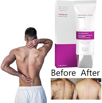 Amazon Com Iusun Hair Removal Cream Unisex Depilatory Painless