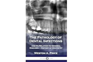The Pathology of Dental Infections: and Its Relation to General Diseases - History of Dentistry