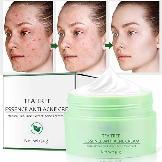 green tea anti acne essence cream