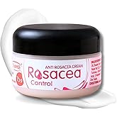 Ovante Facial Redness Cream for Men & Women with Rosacea - 0.5 oz