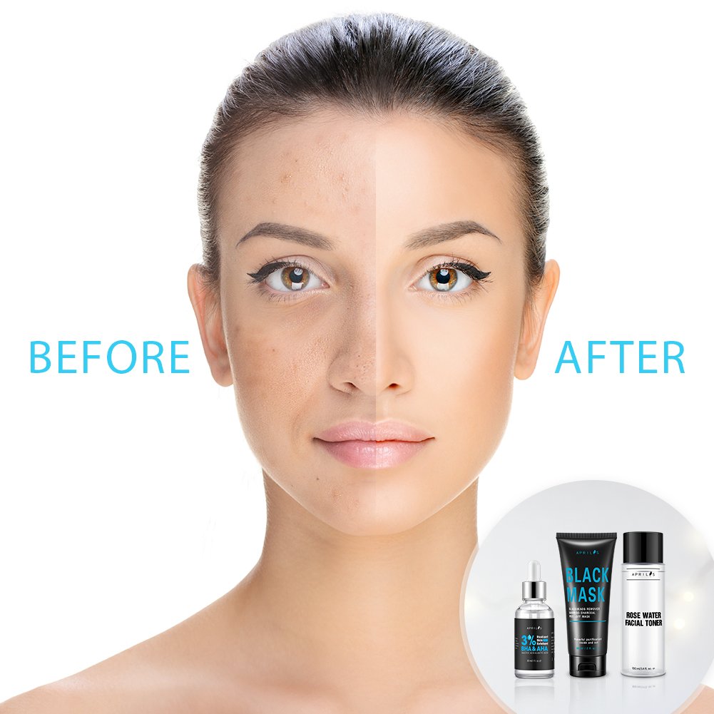 Aprilis Blackhead Remover Set, Scientific 3-Step Solution, Skin Exfoliant, Black Mask and Firming Facial Toner for Removing Blemishes & Blackheads, Radiant Skin Treatment