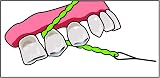 iDontix IDontix Brace X-Floss Green Dental Floss Tool view 6