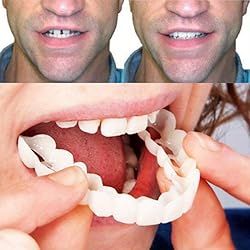 Cosmetic Snap On Teeth Veneers, Upper and Lower