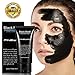 Blackhead Cleansing Mask Finewind Acne Face Mask Deep Clean Blackhead Oil-control Anti-aging Acne Treatment