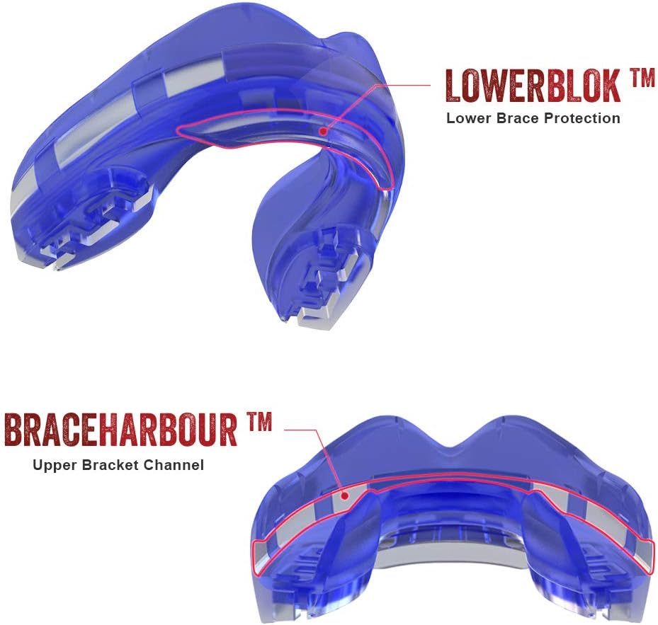 SAFEJAWZ Mouthguard for Braces, One Size Re-Mouldable Mouth Guard with Case for Boxing, Basketball, Football, MMA, Lacrosse, Hockey and All Contact Sports (Ice Blue) : Sports & Outdoors
