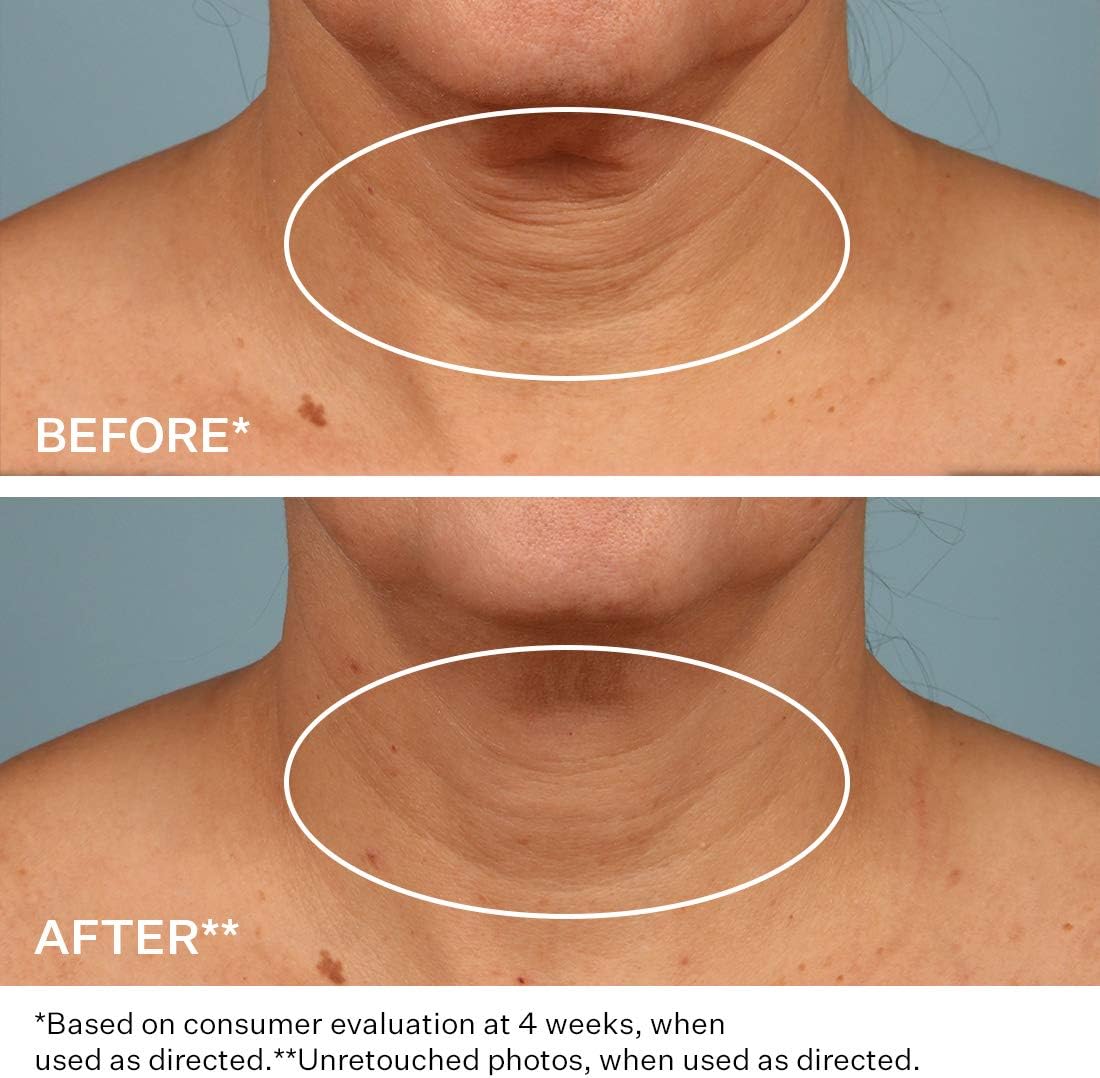 strivectin tightening cream