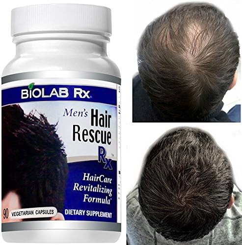 Natural Hair Loss Hair Growth Treatment - Hair Rescue Rx Men - Natural Hair Loss Supplement - Grow Thick Full &amp; Healthy Hair Naturally - Hair Care Hair Loss &amp; Hair Growth Product with Biotin