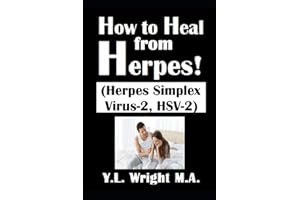 How to Heal from Herpes! (Herpes Simplex Virus-2, HSV-2): How Contagious Is Herpes? Is There a Cure for Herpes? Dating With H