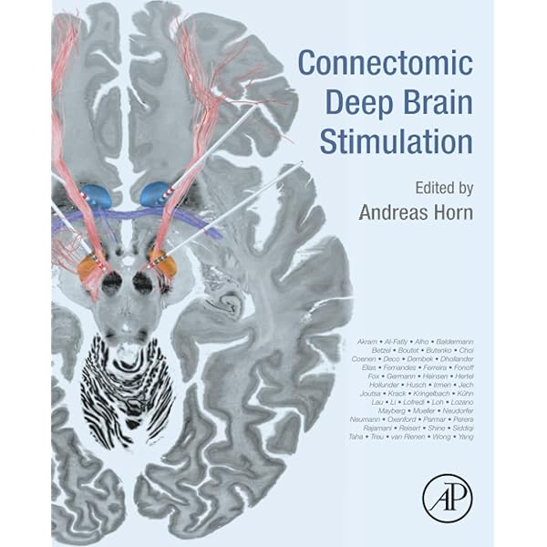 Amazon.com: The Stimulated Brain: Cognitive Enhancement Using Non