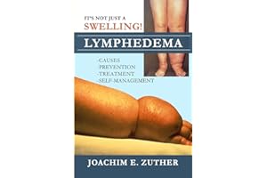 It's Not Just a Swelling! Lymphedema: Causes, Prevention, Treatment, Self-Management