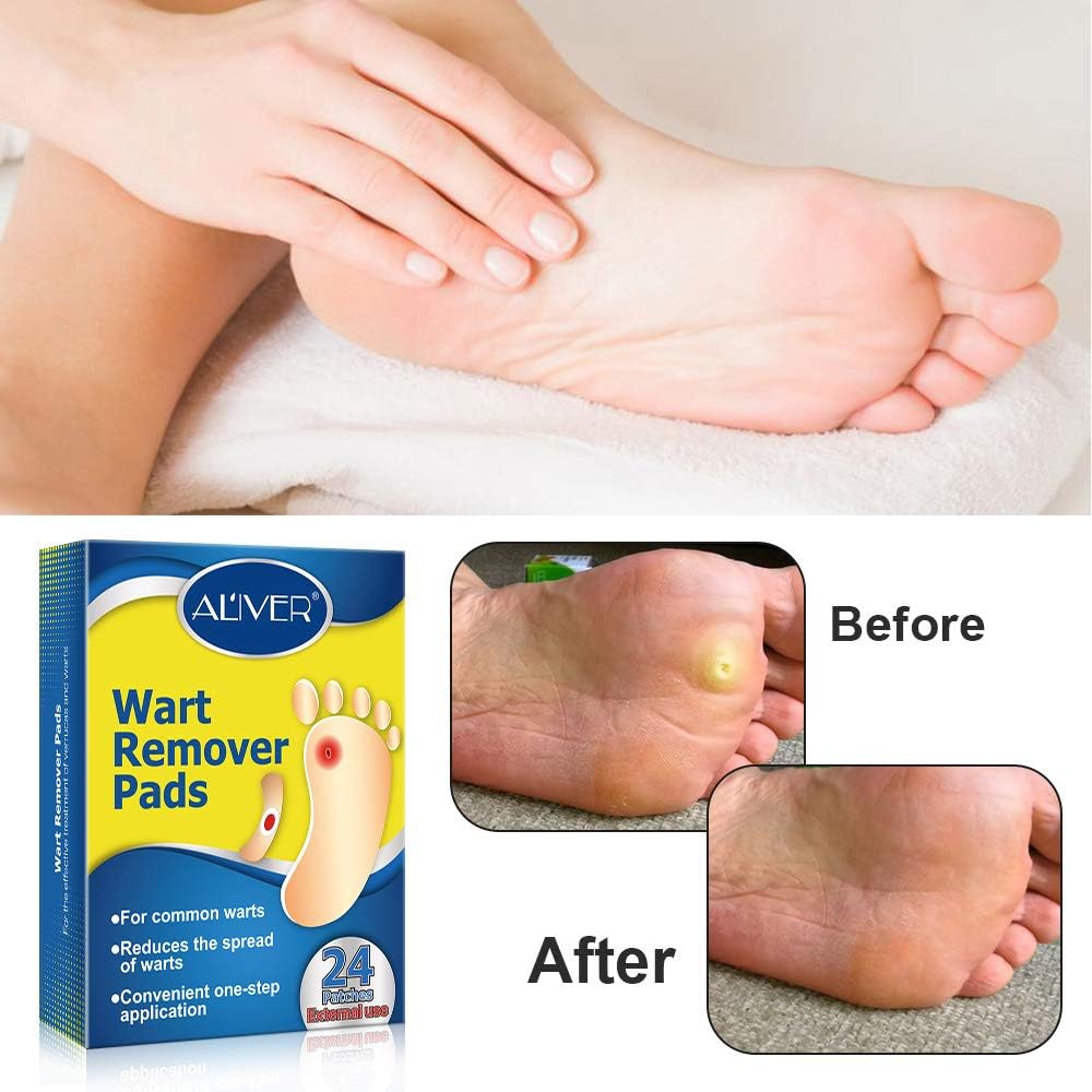 Wart Remover, Wart Removal Plasters Pad, Foot Corn Removal Plaster with Hole, Penetrates and Removes Common and Plantar Warts, Callus,Stops Wart Regrowth 24 Pcs/Box: Health & Personal Care