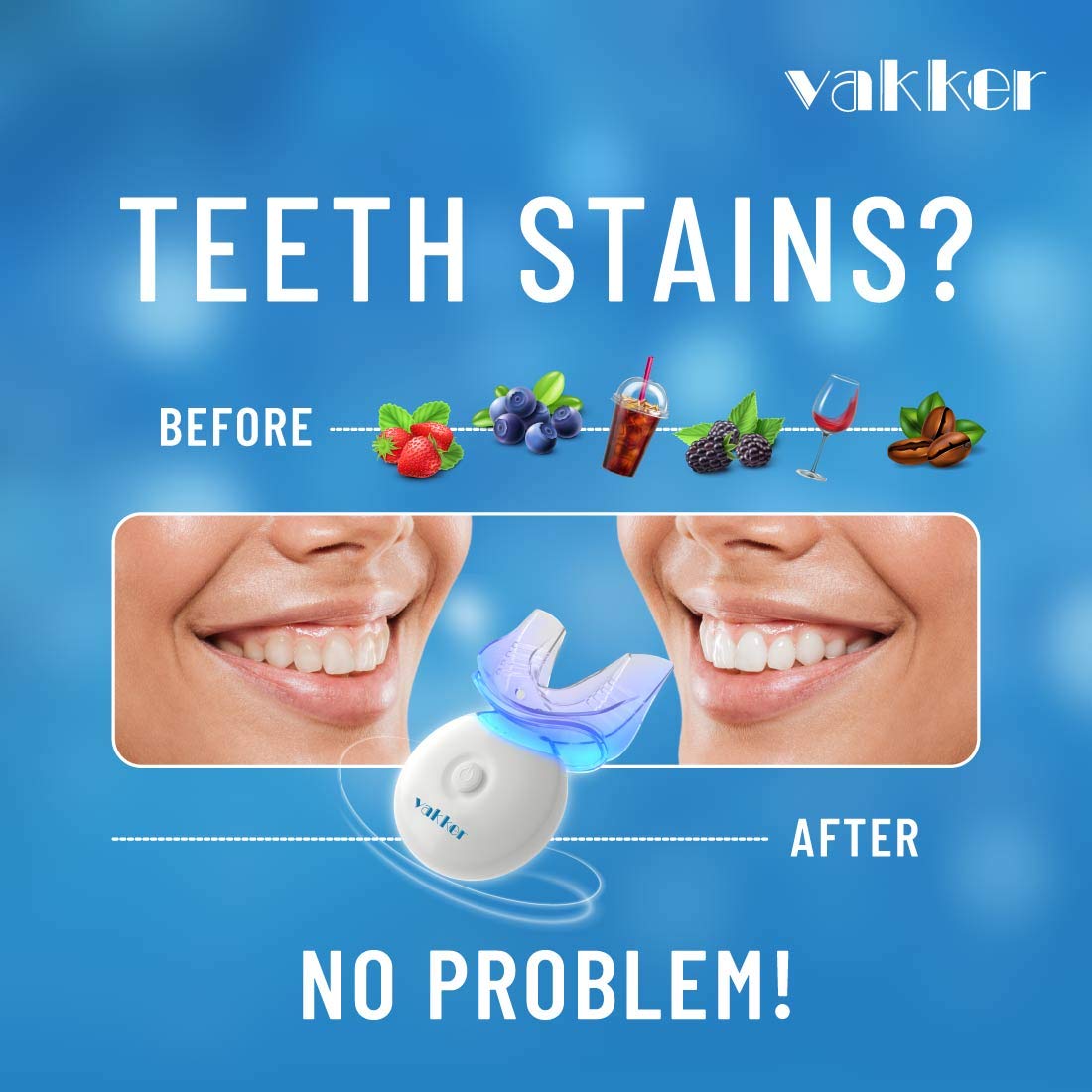 Vakker Teeth Whitening Kit with LED Light, 10min Fast-Result Teeth Whitener, 3 Non-Sensitive 35% Carbamide Peroxide Teeth Whitening Gel Pen and Tray to Help Remove Teeth Stain from Coffee Drinks Food: Beauty