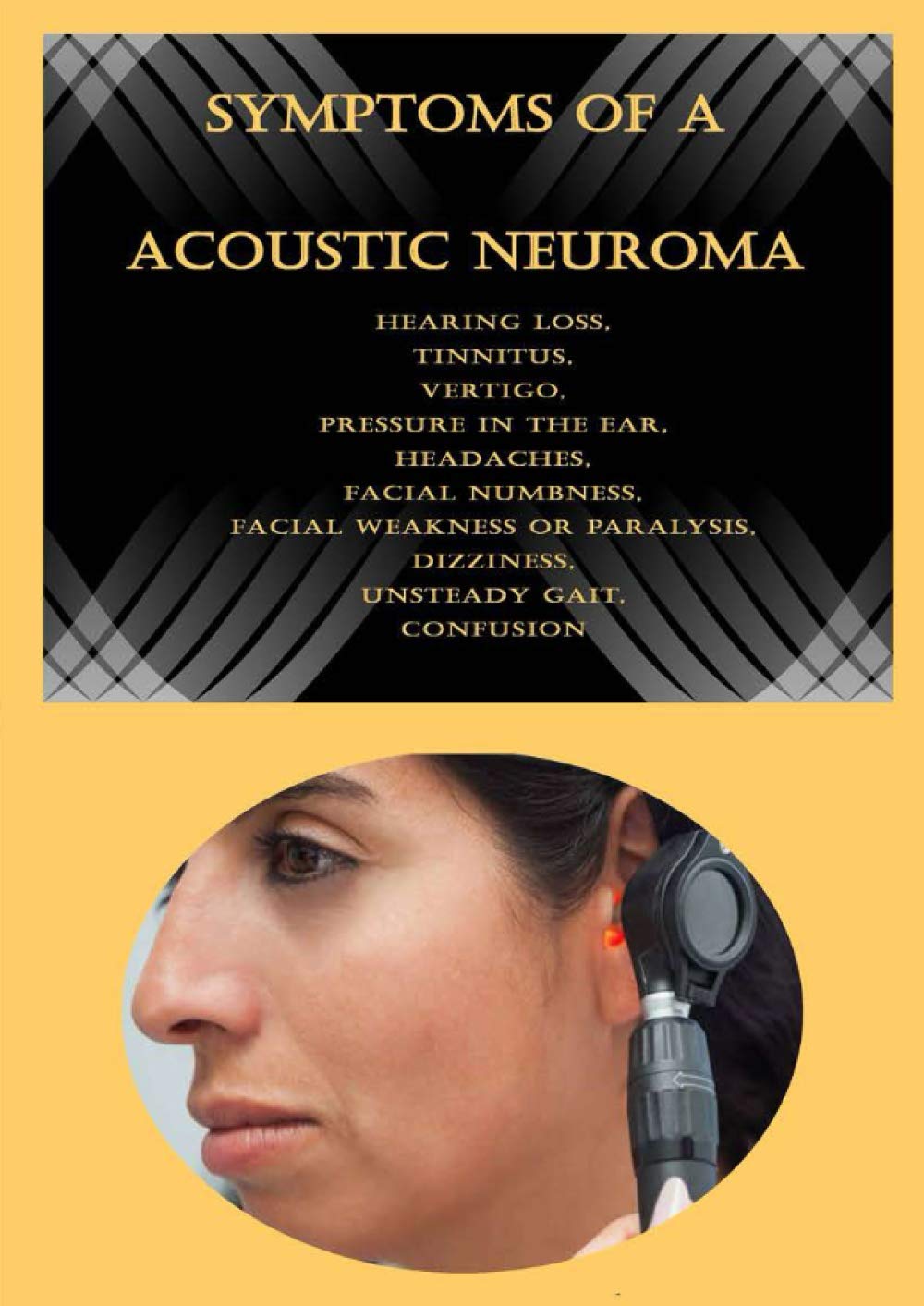 Acoustic neuroma facial Telegraph