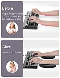 Vaydeer 2Pcs Cloud Elbow Pads, Desk Arm Rest