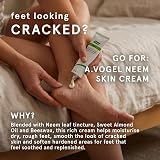A.Vogel Neem Cream for Dry & Eczema-Prone Skin 50g Natural Moisturising view 4