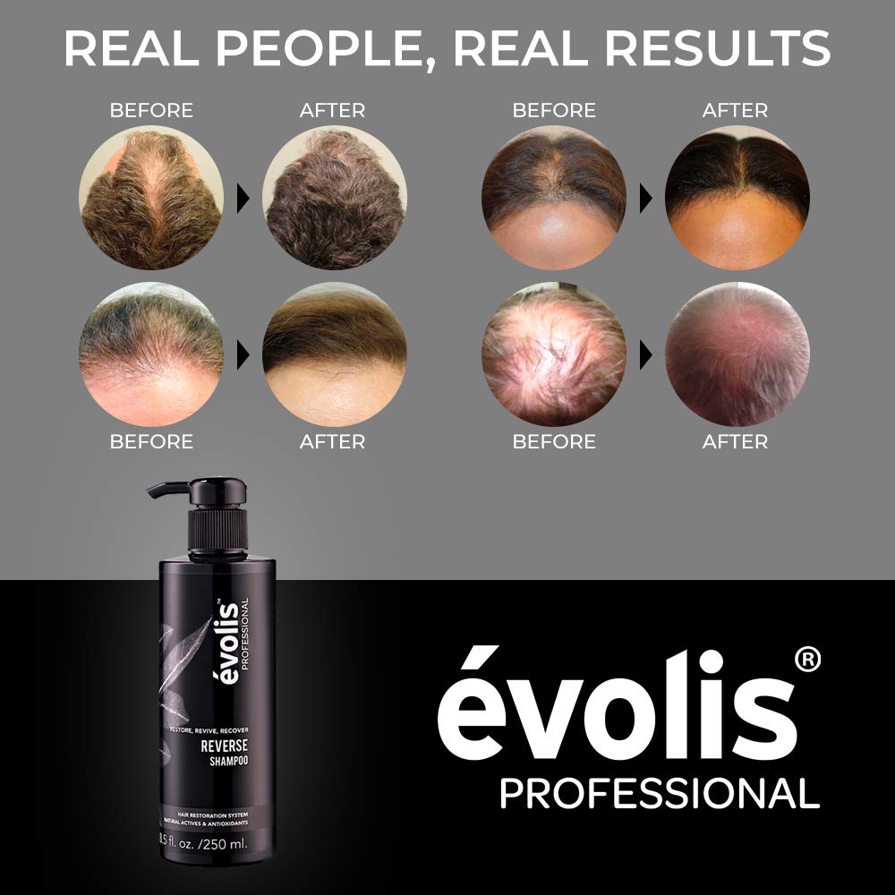 évolis REVERSE Shampoo - Hair Growth Shampoo - Keratin Shampoo Sulfate Free - Natural Hair Growth Shampoo with Keratin and Wheat Protein - Hair Growth Treatment (8.5 fl oz): Beauty