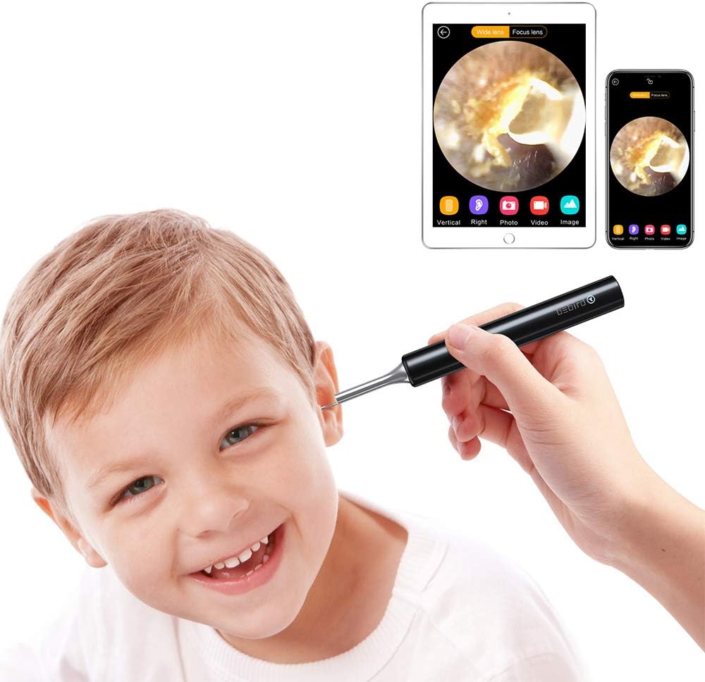 Hmount Ear Wax Removal Tool, Ear Wax Removal Endoscope, Super Light Lens WiFi Ear Endoscope with 6 LED Lights, 080P FHD Wireless Ear Otoscope Camera with 3-Axis Gyroscope, Black