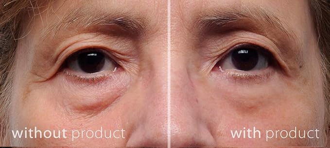 my perfect eyes dark circles