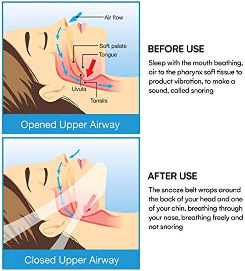 Anti Snore Snoring Chin Strap Devices for Men Women Kids, Anti Snoring Snore Chin Strap Large, Anti My Snoring Snore Solution, Resmed Cpap Supplies Chin Straps: Health & Personal Care