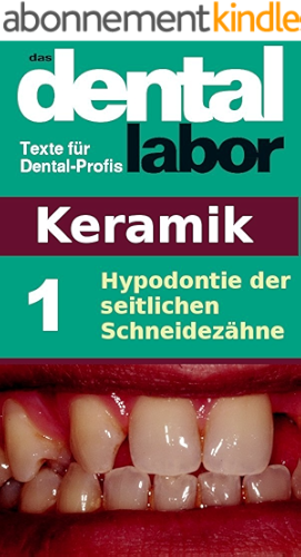 Download Hypodontie der seitlichen Schneidezähne (das dental labor Fachtexte 2) (German Edition) PDF