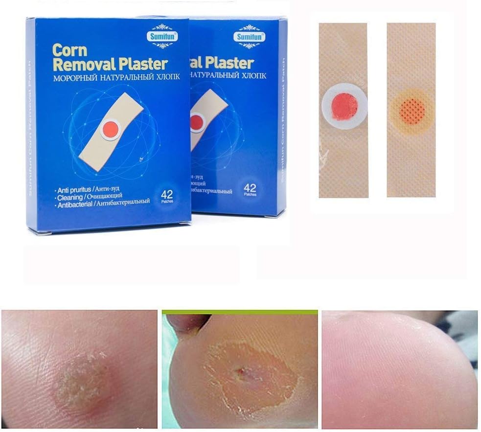 foot corn removal plaster