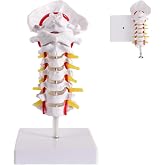 Cervical Spine Model Anatomy with Cervical Vertebrae, Cervical Nerves, Vertebrobasilar System &amp; Occipital Plate, Scientific Life Size Human Cervical Spine Vertebrae Model for Medical Anatomy Education