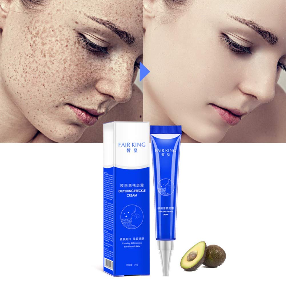 cream for freckles and age spots
