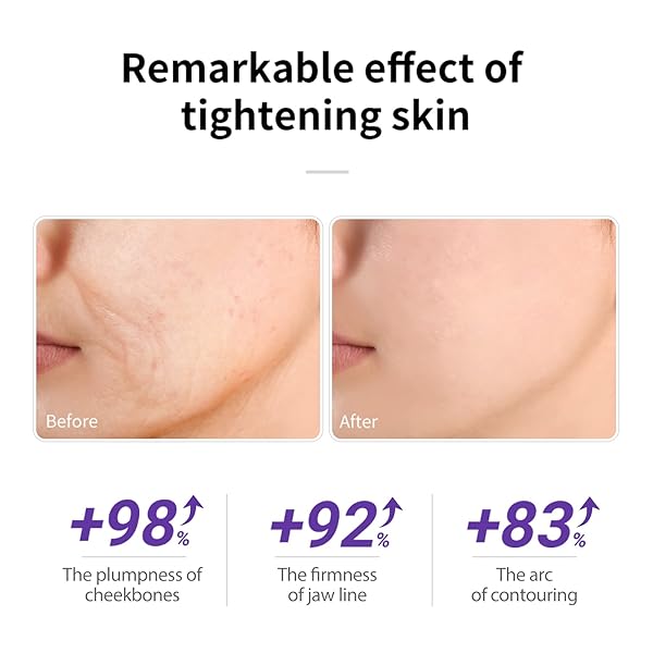 LANBENA RETINOL SERUM FOR FACE, RETINOL SERUM WITH HYALURONIC ACID FOR WRINKLES AND FINE LINES, RENEW AND PLUMP NIGHT FACIAL SERUM FOR GLOWING SKIN, SERUM FOR SENSITIVE SKIN, 30ML