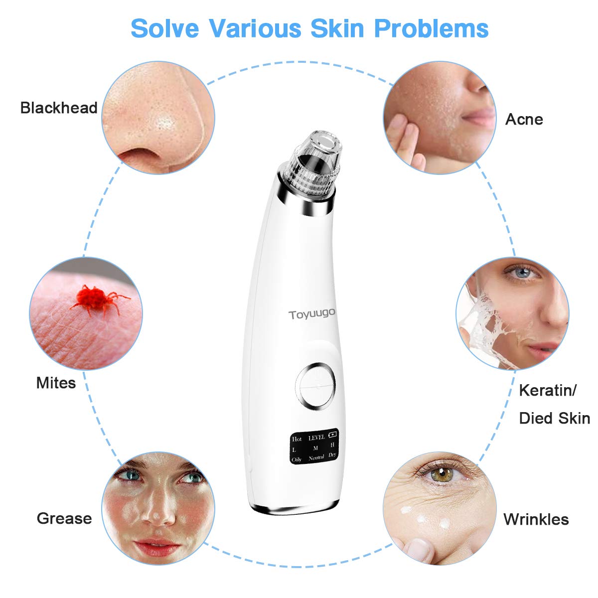 blackhead vacuum remover acne remover, toyuugo Facial Pore Cleanser Electric Acne Comedone, 3 Adjustable Suction Power, USB Rechargeable, LED Screen Blackhead Extractor Tool for Women and Men: Beauty