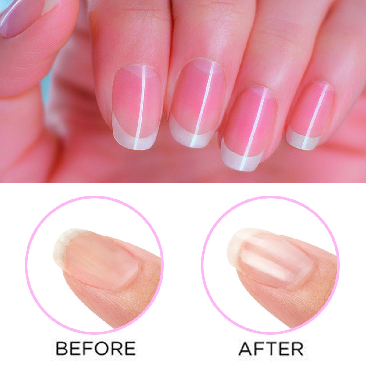 Gotofine Electric Nail polisher, Nail Buffer Tool, Professional Manicure & Nail Care System - File, Buff and Shine Nails Instantly(Includes 3 Rollers)