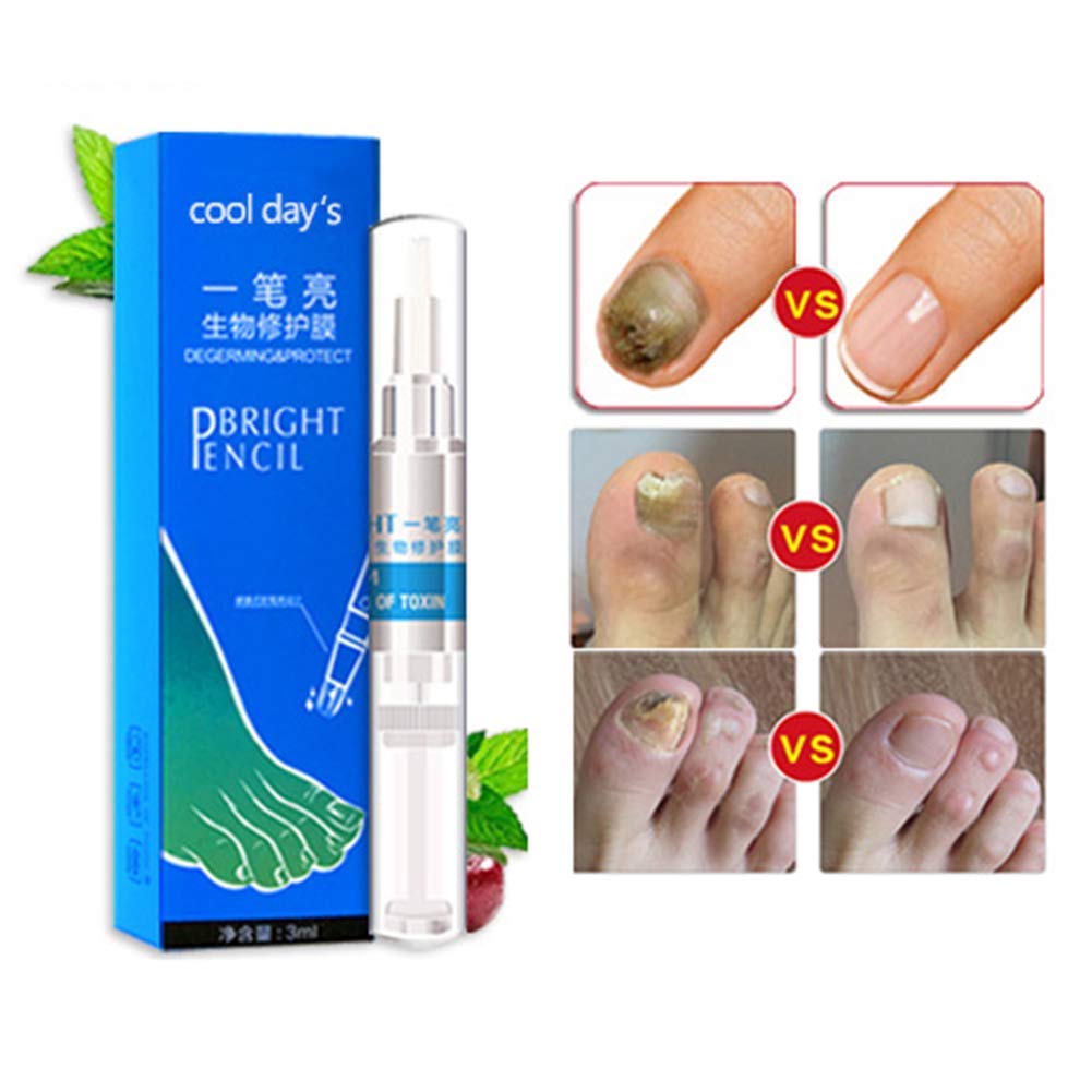 Natural Fungus Nail Repair Pen Fungal Nail Eliminator Nail Fungus Treatment Pen for Fingernails and Toenails : Beauty