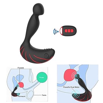 Prostata bei der frau